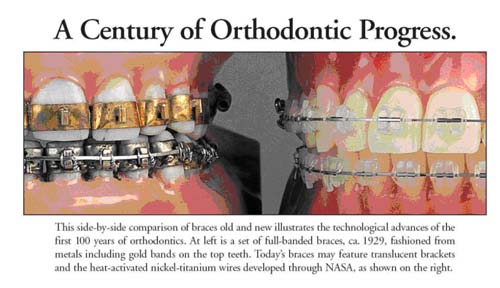 Orthodontic History Part 3 Landm Orthodontics Orthodontists In 