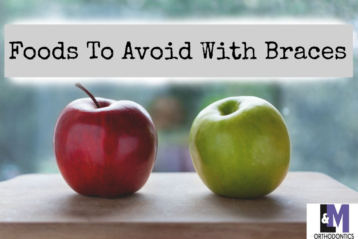 Foods to Avoid With Braces