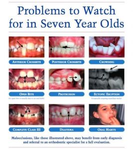 Phase I in Orthodontic Treatment