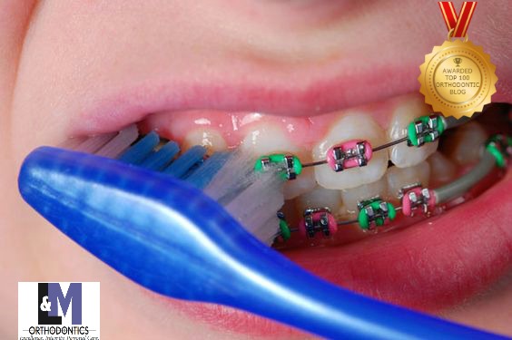 Brushing With Braces L&M Orthodontics