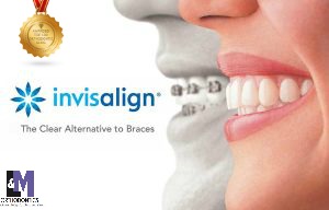 Adult Braces and Invisalign