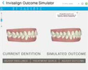 iTero Scanner at L&M Orthodontics