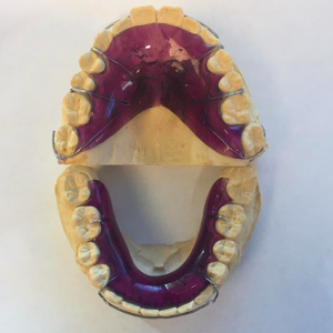 Retainer Care LM Orthodontics