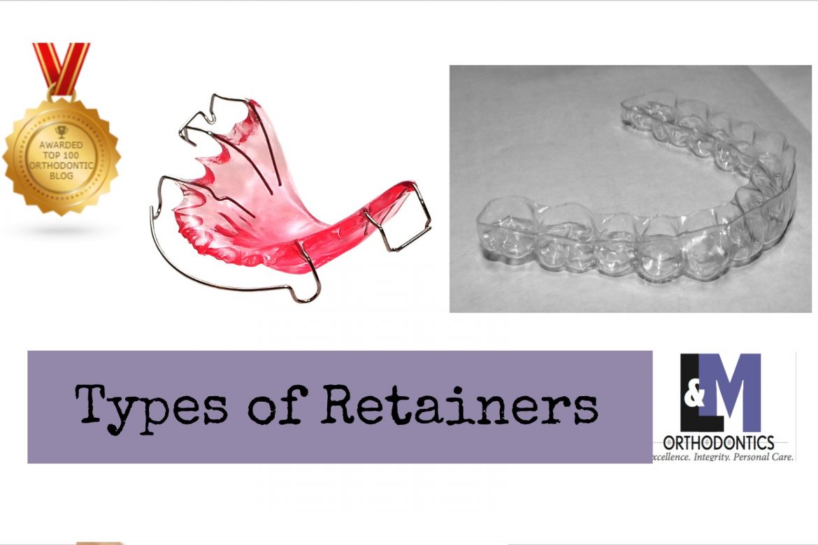 Types of Retainer