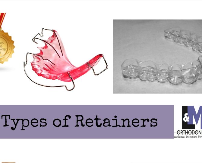 Types of Retainer